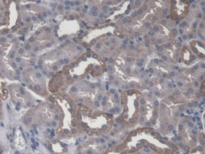 CBF beta Antibody in Immunohistochemistry (Paraffin) (IHC (P))