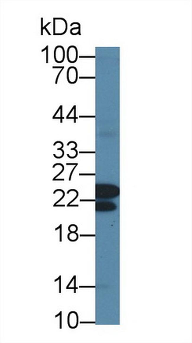 CBF beta Antibody in Western Blot (WB)