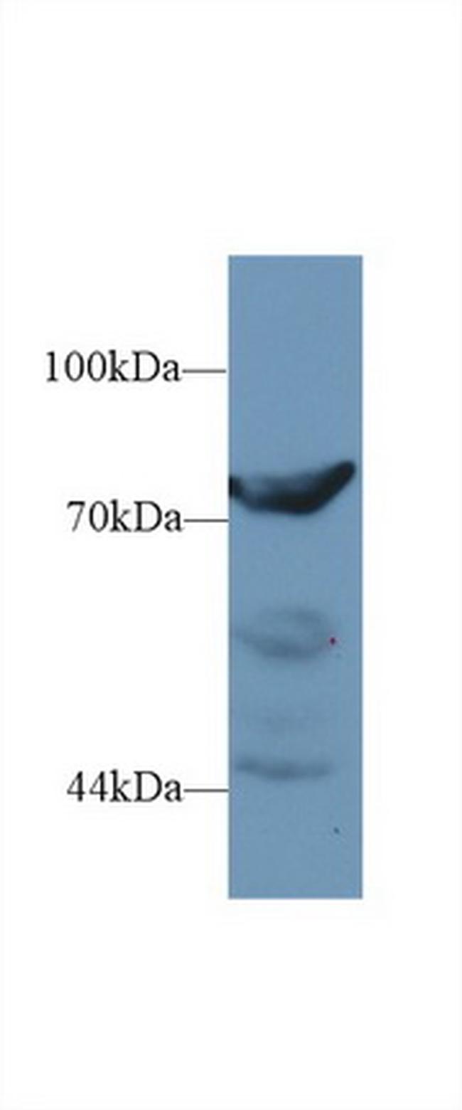 DPP3 Antibody in Western Blot (WB)