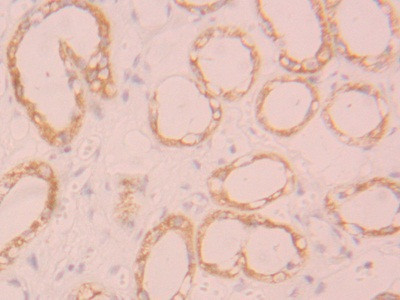 FGL1 Antibody in Immunohistochemistry (Paraffin) (IHC (P))