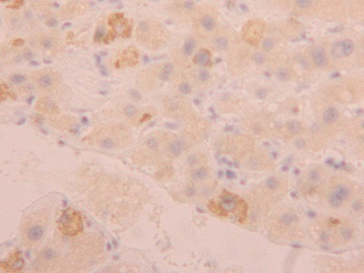 FGL1 Antibody in Immunohistochemistry (Paraffin) (IHC (P))