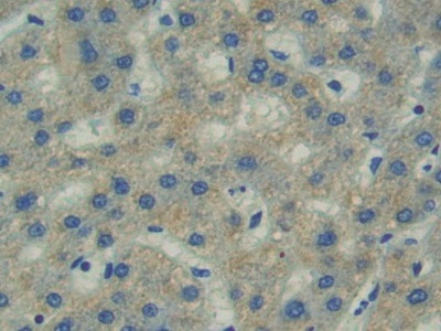 FAK Antibody in Immunohistochemistry (Paraffin) (IHC (P))