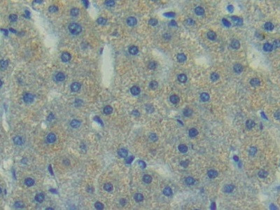 FAK Antibody in Immunohistochemistry (Paraffin) (IHC (P))