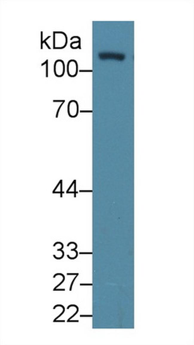 FAK Antibody in Western Blot (WB)