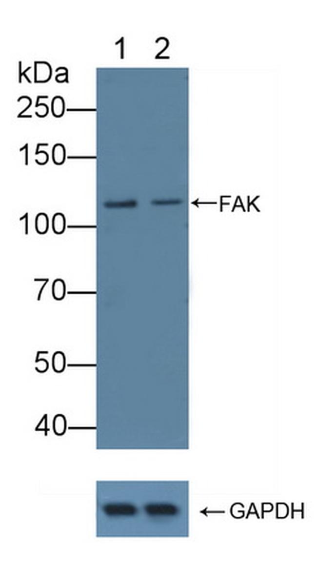 FAK Antibody in Western Blot (WB)