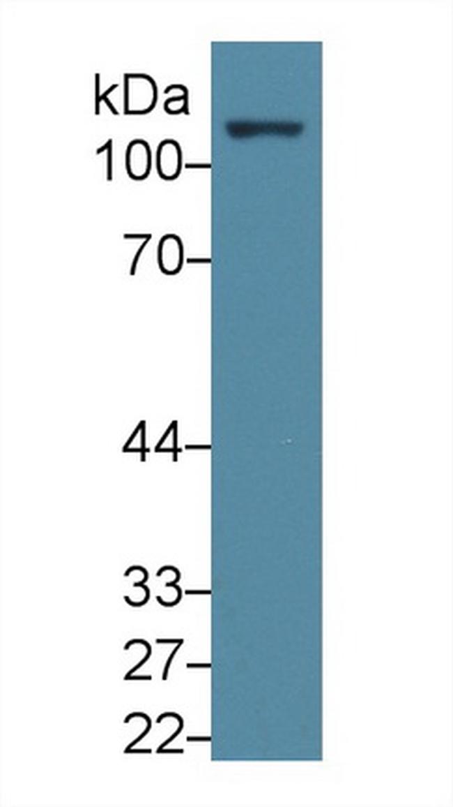 FAK Antibody in Western Blot (WB)