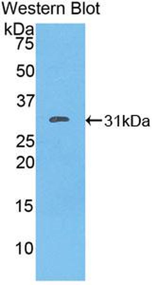 FAK Antibody in Western Blot (WB)