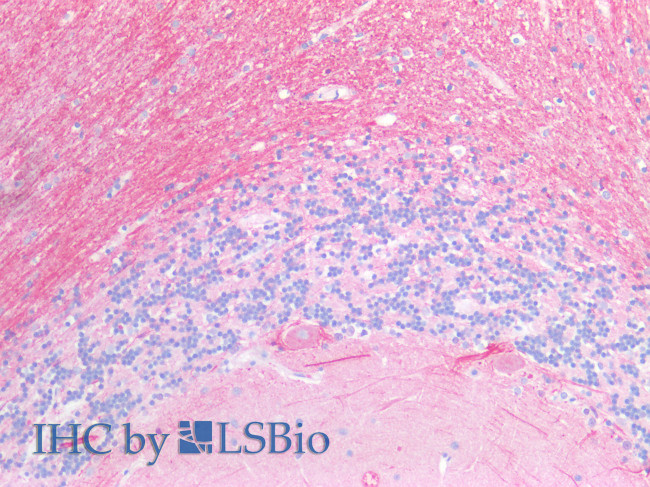 GNA11 Antibody in Immunohistochemistry (Paraffin) (IHC (P))