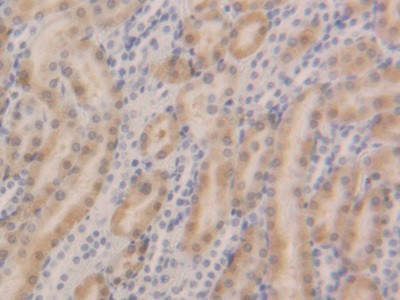 GSTA5 Antibody in Immunohistochemistry (Paraffin) (IHC (P))