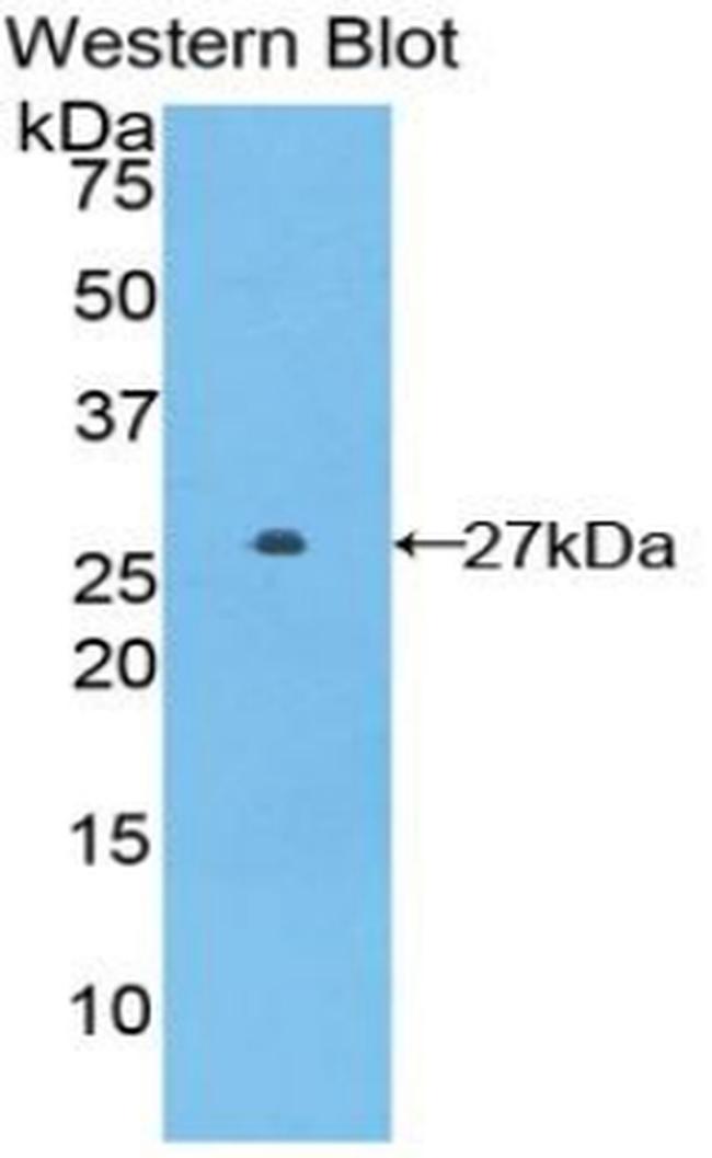 GSTA5 Antibody in Western Blot (WB)