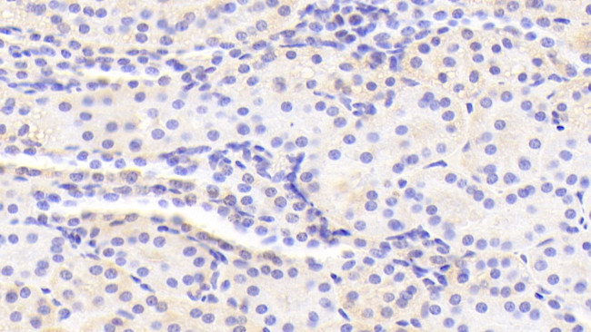 GDA Antibody in Immunohistochemistry (Paraffin) (IHC (P))