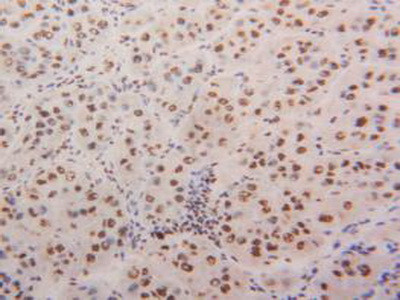 hnRNP A2B1 Antibody in Immunohistochemistry (Paraffin) (IHC (P))