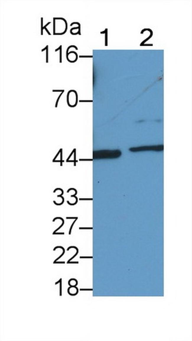 IL31RA Antibody in Western Blot (WB)