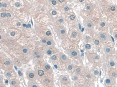 KATNA1 Antibody in Immunohistochemistry (Paraffin) (IHC (P))