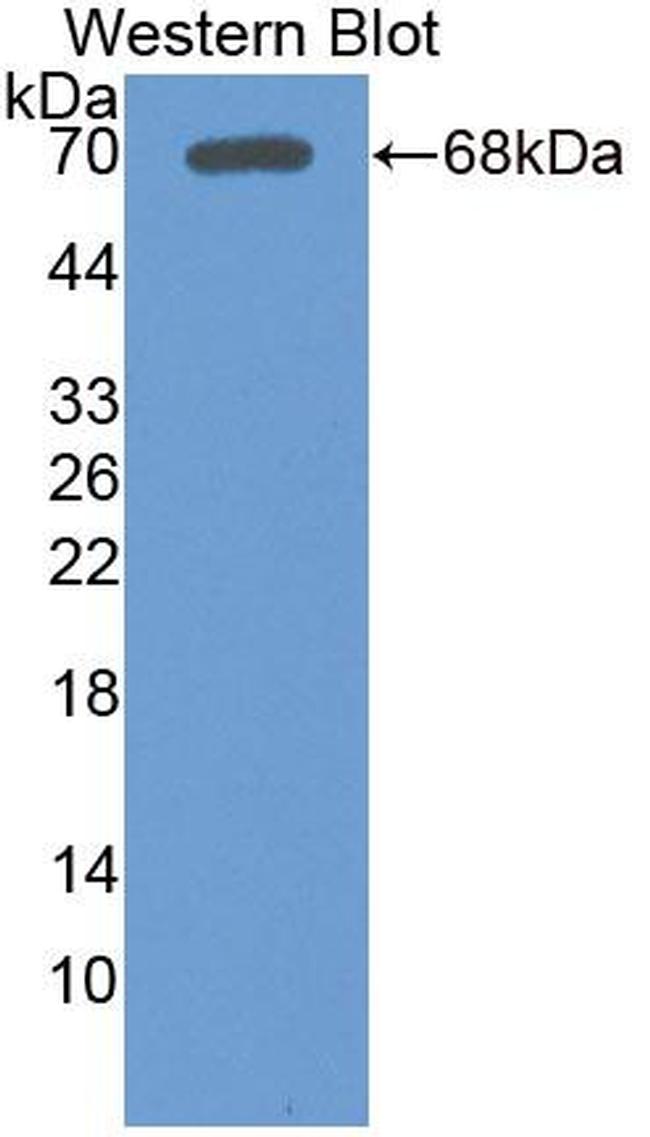 LSR Antibody in Western Blot (WB)