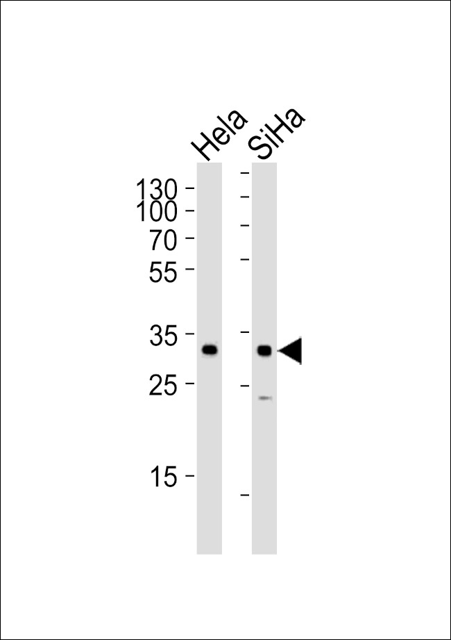 SNAIL Antibody in Western Blot (WB)