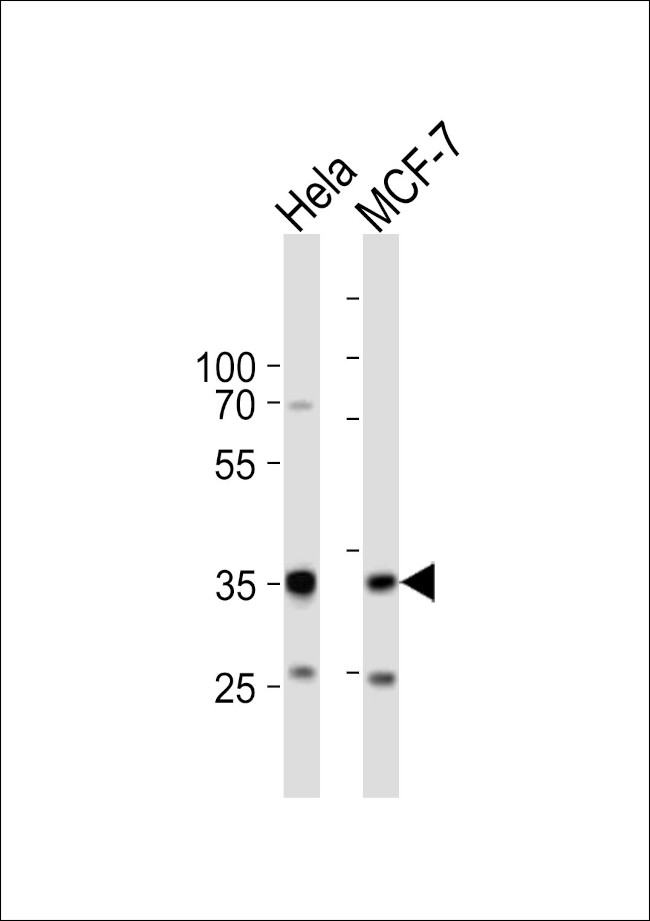 SNAIL Antibody in Western Blot (WB)