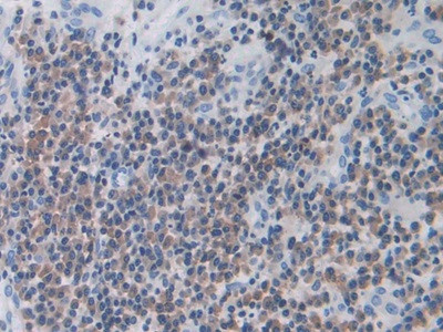 MX1 Antibody in Immunohistochemistry (Paraffin) (IHC (P))