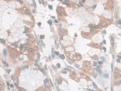 Nesprin 2 Antibody in Immunohistochemistry (Paraffin) (IHC (P))