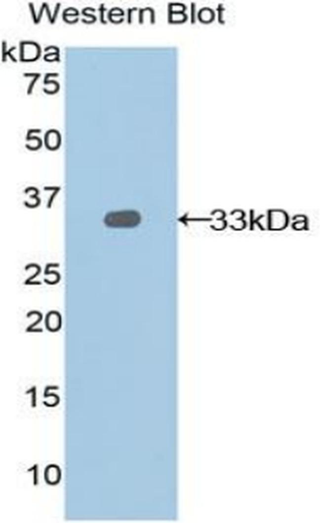 Nexilin Antibody in Western Blot (WB)