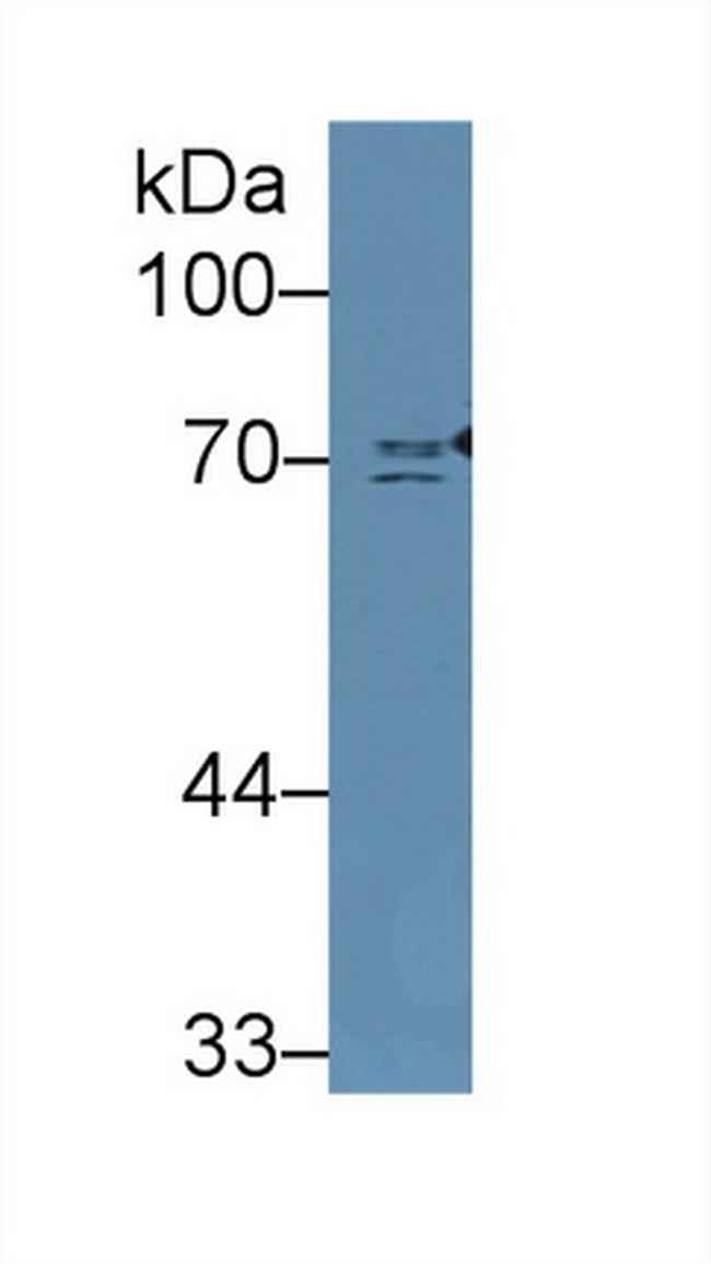 NUMB Antibody in Western Blot (WB)