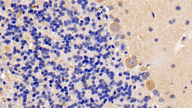 OSMR Antibody in Immunohistochemistry (Paraffin) (IHC (P))