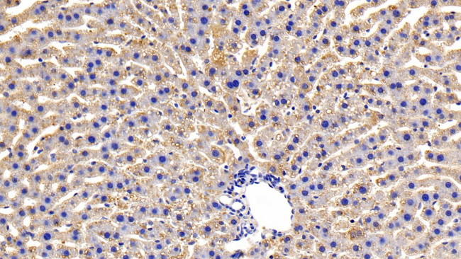 OSMR Antibody in Immunohistochemistry (Paraffin) (IHC (P))