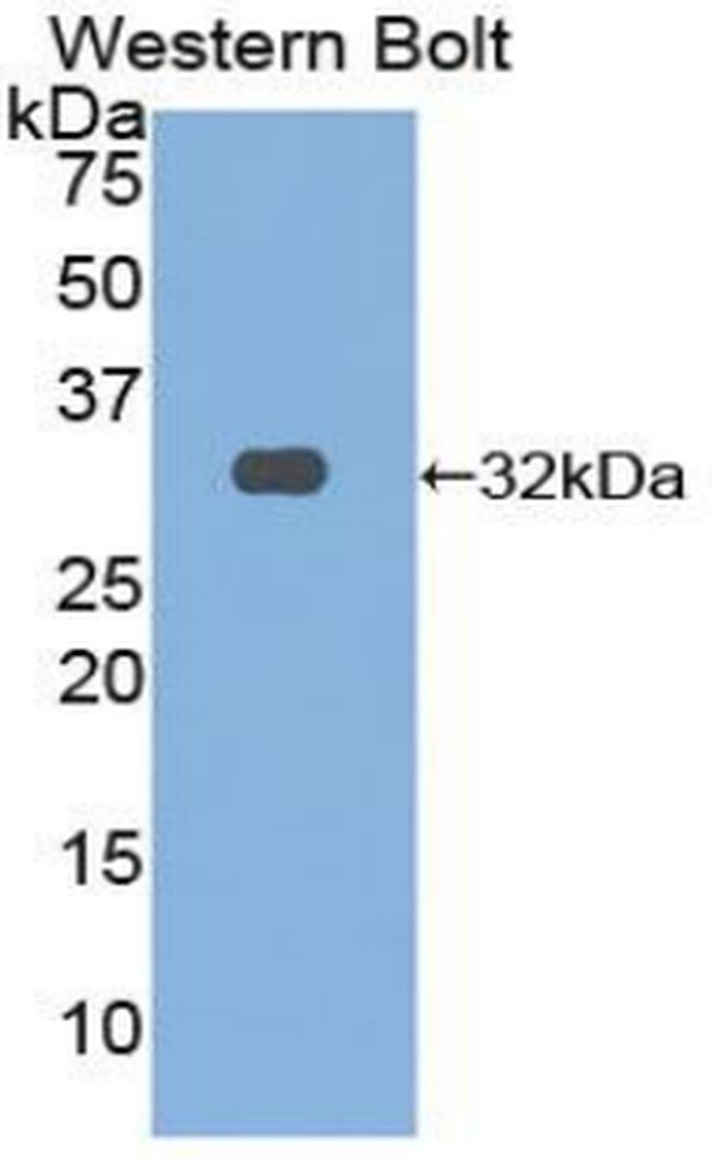 OSMR Antibody in Western Blot (WB)