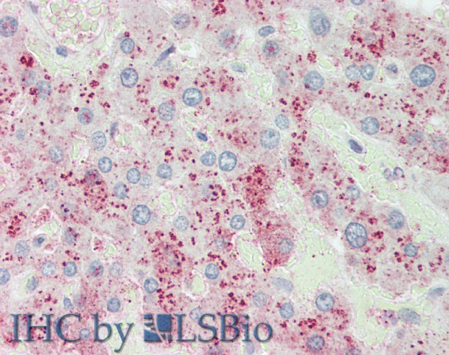 ORM2 Antibody in Immunohistochemistry (Paraffin) (IHC (P))