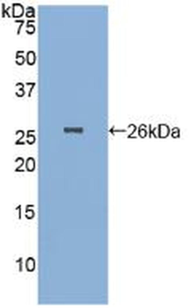 PGA5 Antibody in Western Blot (WB)