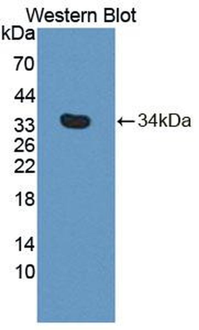 PLCD4 Antibody in Western Blot (WB)