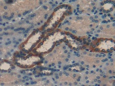 RBP1 Antibody in Immunohistochemistry (Paraffin) (IHC (P))