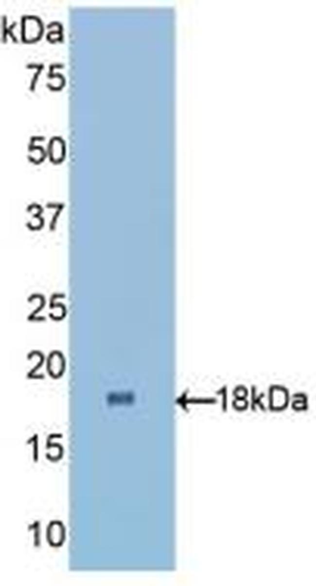 RBP1 Antibody in Western Blot (WB)