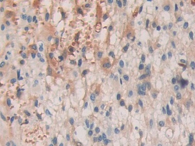 SHC3 Antibody in Immunohistochemistry (Paraffin) (IHC (P))