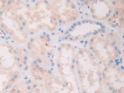 SLIT1 Antibody in Immunohistochemistry (Paraffin) (IHC (P))