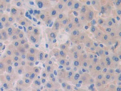 SLIT1 Antibody in Immunohistochemistry (Paraffin) (IHC (P))