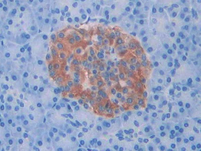 SLIT1 Antibody in Immunohistochemistry (Paraffin) (IHC (P))