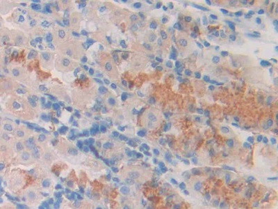 SLIT1 Antibody in Immunohistochemistry (Paraffin) (IHC (P))