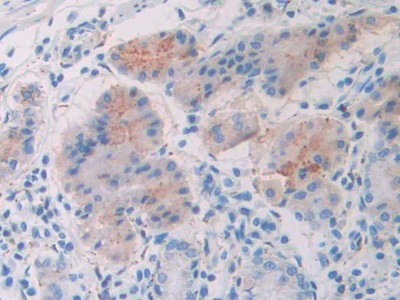 SLIT1 Antibody in Immunohistochemistry (Paraffin) (IHC (P))