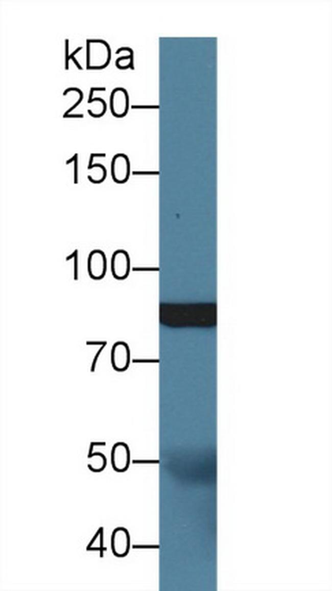 SLIT1 Antibody in Western Blot (WB)