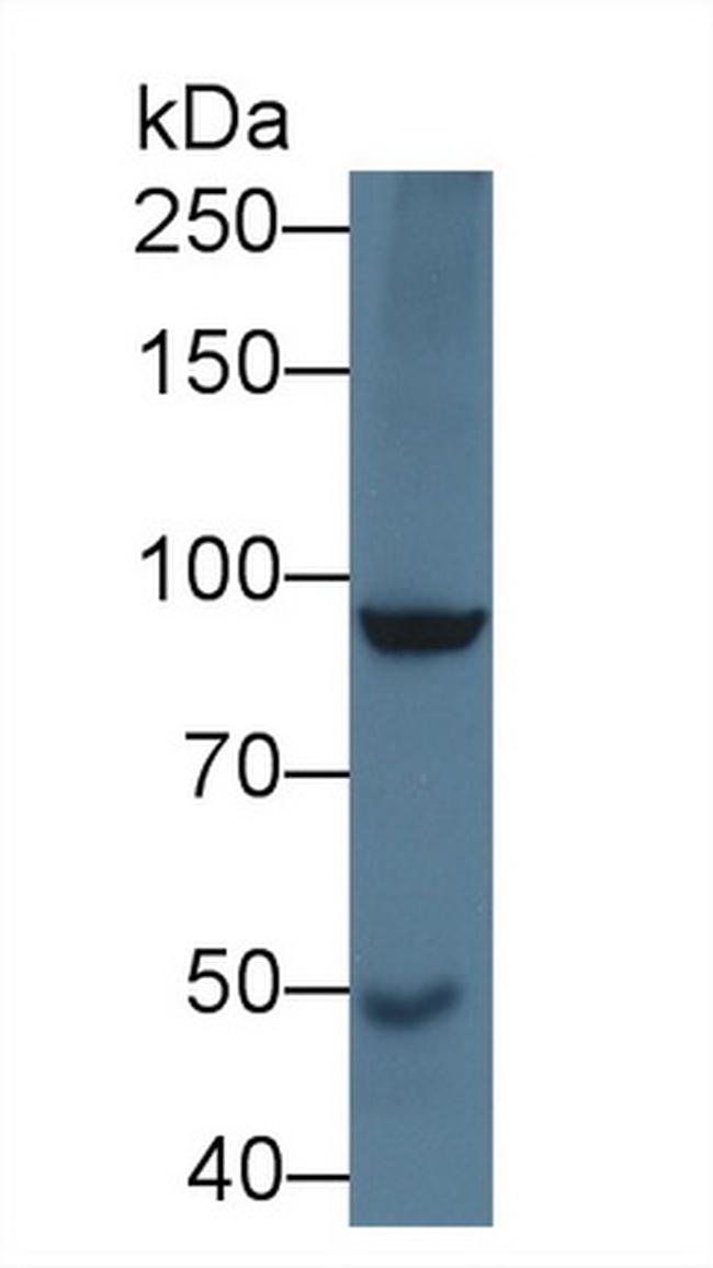 SLIT1 Antibody in Western Blot (WB)