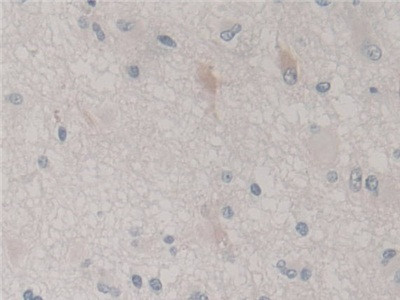 SKP1 Antibody in Immunohistochemistry (Paraffin) (IHC (P))