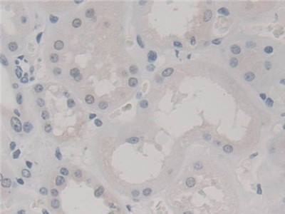 SKP1 Antibody in Immunohistochemistry (Paraffin) (IHC (P))