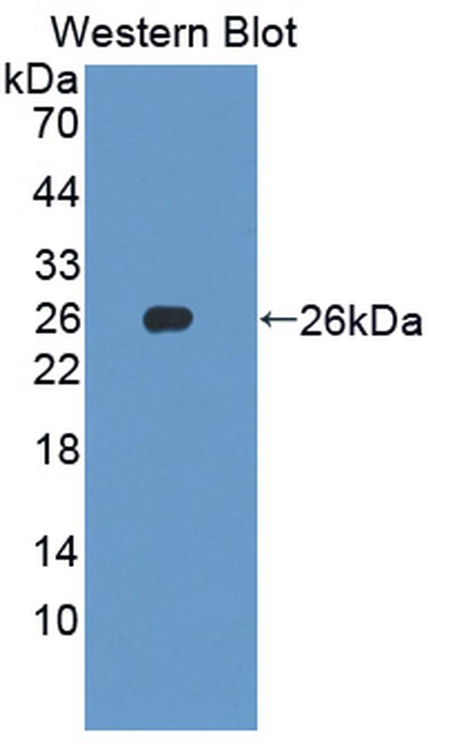 SKP1 Antibody in Western Blot (WB)