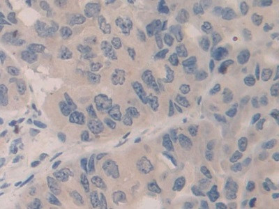 SMC3 Antibody in Immunohistochemistry (Paraffin) (IHC (P))