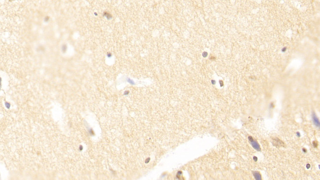 TUBB1 Antibody in Immunohistochemistry (Paraffin) (IHC (P))