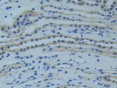 TNFR1 Antibody in Immunohistochemistry (Paraffin) (IHC (P))