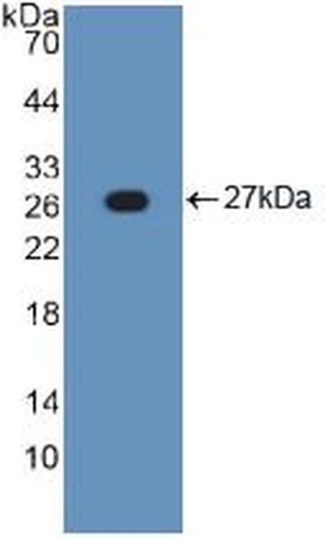 TNFR1 Antibody in Western Blot (WB)