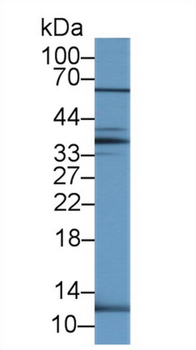 UCN2 Antibody in Western Blot (WB)