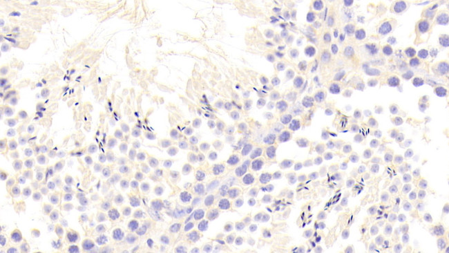 VWA1 Antibody in Immunohistochemistry (Paraffin) (IHC (P))